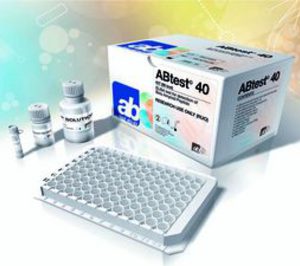 Araclón inicia contactos con farmacéuticas para la licencia de su kit ABtest
