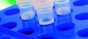 3i traspasará su 20% en el grupo de análisis Labco