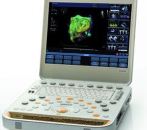 Philips presenta su equipo portátil xMatrix CX50