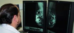 Xanit incorpora una unidad de mama