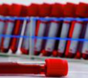 Nimgenetics espera alcanzar los 4 M de ingresos en 2013