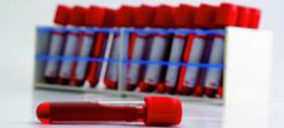 Nimgenetics espera alcanzar los 4 M de ingresos en 2013