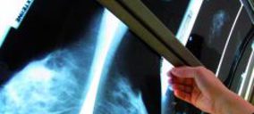 Extremadura saca a concurso un servicio de mamografías