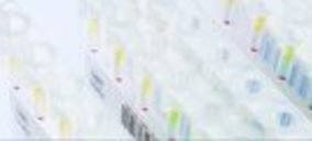 Labco incorpora un nuevo test de diagnóstico preconcepcional