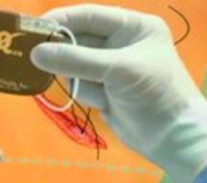 HM Hospitales incorpora un nuevo desfibrilador automático en su hospital de Montepríncipe