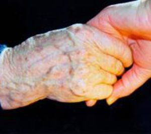 AFALcontigo firma acuerdos de colaboración con entidades de tres países