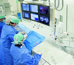 Philips presenta una tecnología para oncología intervencionista