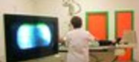 Madrid destina 9 M a tratamientos de radioterapia y equipos de diagnóstico