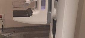 Nisa Pardo de Aravaca presenta un nuevo servicio de diagnóstico 3D para oncología