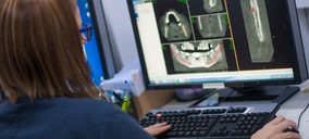 Dentalliance abre un nuevo centro Xplora 3D Imaging