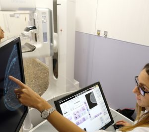 El Hospital HM Delfos se refuerza con un mamógrafo de última generación