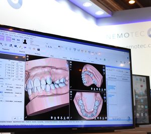 Nemotec mejora su software de diseño de sonrisas con una nueva funcionalidad