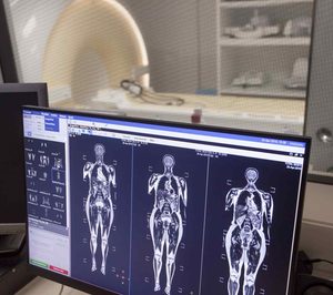 Hospiten adquiere resonancias magnéticas para sus hospitales de Madrid, Tenerife y Lanzarote