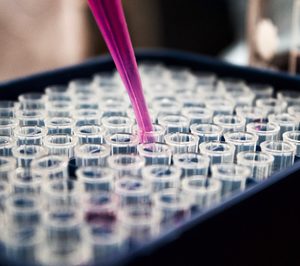 Mars y Nestlé se alían para el reciclado químico