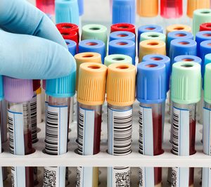 Grupo Docuworld intensifica la producción para el sector sanitario e invierte en una de sus plantas