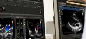 Murcia conectará los datos cardiológicos de los pacientes entre AP y hospitales con una herramienta de Philips