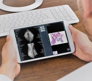 Telefónica y Dedalus impulsarán la digitalización de la anatomía patológica