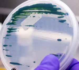 Unilever abre una nueva línea de I+D con la chlorella para potenciar su gama vegetal