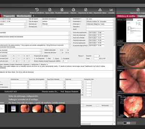 Nexus presenta en España el software Nexus/Diagnostics para elaborar informes de gastroenterología