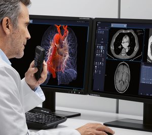 HT Médica y Siemens Healthineers presentan su proyecto de Diagnóstico por Imagen apoyado en Inteligencia Artificial