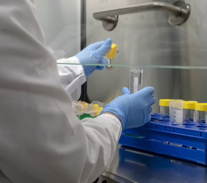 Palex lanza en España una herramienta para personalizar la terapia de los pacientes de trasplante de riñon, desarrollada por Biohope