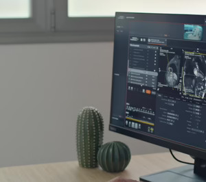 HT Médica incorpora un nuevo software de asistencia en remoto de Siemens Healthineers