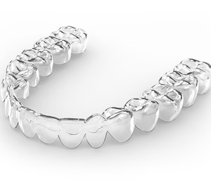 Simplicity Aligners absorbe la actividad de Perfektesmil en España