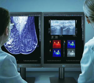 LG refuerza su oferta B2B con un monitor de diagnóstico médico de 5 megapíxeles