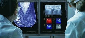 LG refuerza su oferta B2B con un monitor de diagnóstico médico de 5 megapíxeles