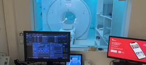 El hospital Ribera IMSKE incorpora una nueva resonancia y una densitometría DEXA que mide la grasa corporal
