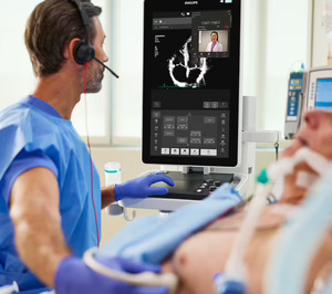 Philips lanza su nuevo sistema de ecografía móvil Flash 5100 POC