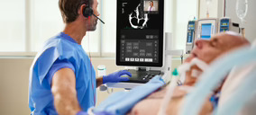 Philips lanza su nuevo sistema de ecografía móvil Flash 5100 POC