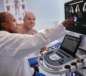 Philips presenta Transcend Plus, su último avance en ecocardiografía