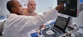 Philips presenta Transcend Plus, su último avance en ecocardiografía
