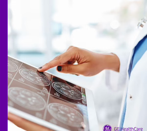 GE HealthCare anuncia un acuerdo para adquirir Intelerad, proveedor de software de imágenes médicas para el sector sanitario
