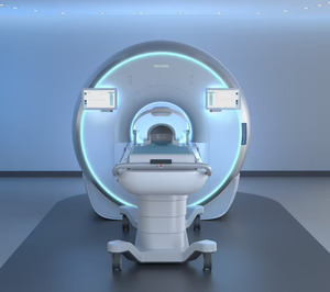 Philips presenta dos innovaciones de diagnóstico por imagen