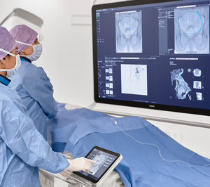 El consorcio de investigación PreciseOnco, coordinado por Philips, recibe una subvención de 14,9 M de la IHI para impulsar avances en el tratamiento oncológico de precisión