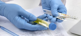 Quirónsalud se perfila como ganador del servicio del Laboratorio Clínico Central de Madrid por más de 120 M