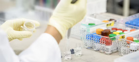 Sysmex lanza un kit de análisis para la detección de un biomarcador relacionado con el Alzheimer