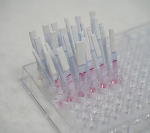 ITENE desarrolla un sistema de detección rápida de patógenos con biosensores avanzados