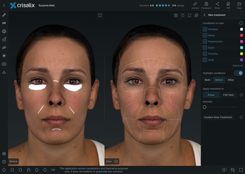 Dorsia lleva la simulación estética 3D a todo el recorrido de los pacientes, desde la web hasta la consulta
